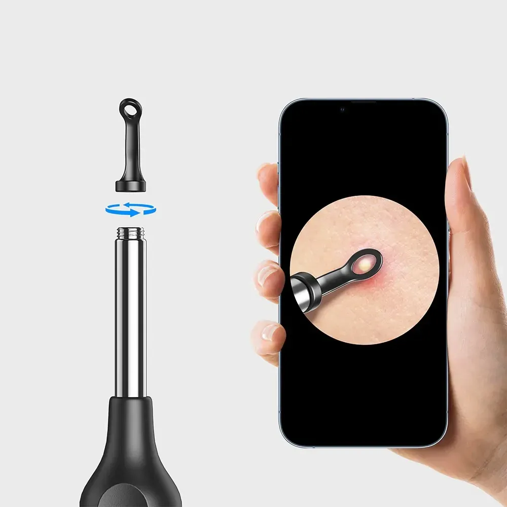 Ложка Uno для эндоскопов Heaco Днепр - изображение 2