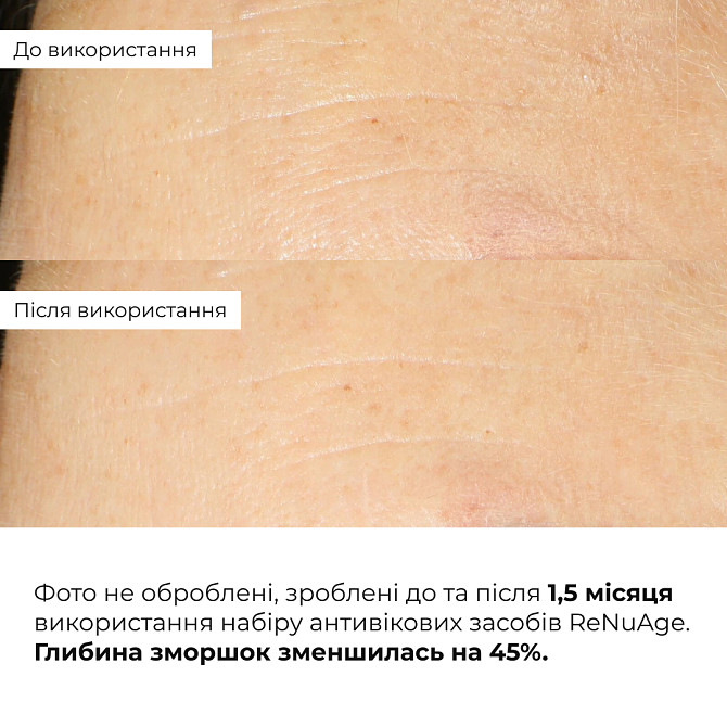 Комплексна антивікова система ReNuAge Total Anti-Aging System Hillary Вінниця - фото 9