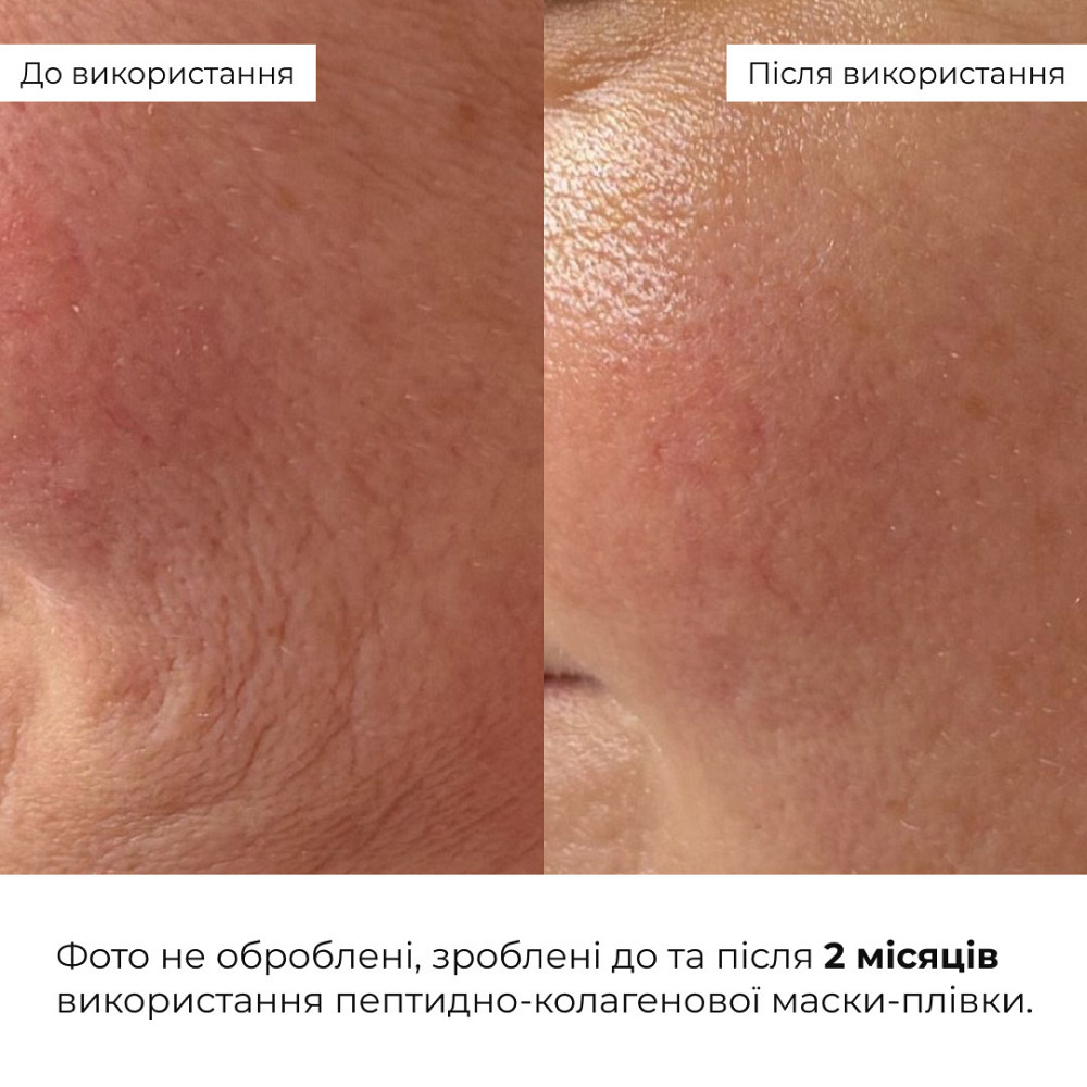 Набір для ліфтингу та ревіталізації шкіри обличчя Hillary Lifting & Revitalizing Face Kit Киев - изображение 2