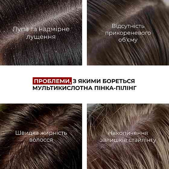 Набор для очищения кожи головы и восстановления поврежденных волос HiLLARY Киев