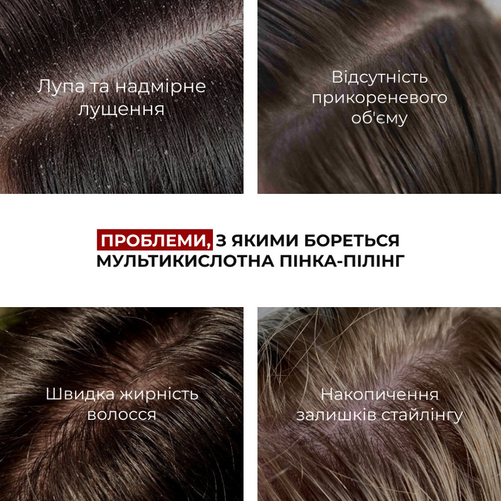 Набор для очищения кожи головы и восстановления поврежденных волос HiLLARY Киев - изображение 3