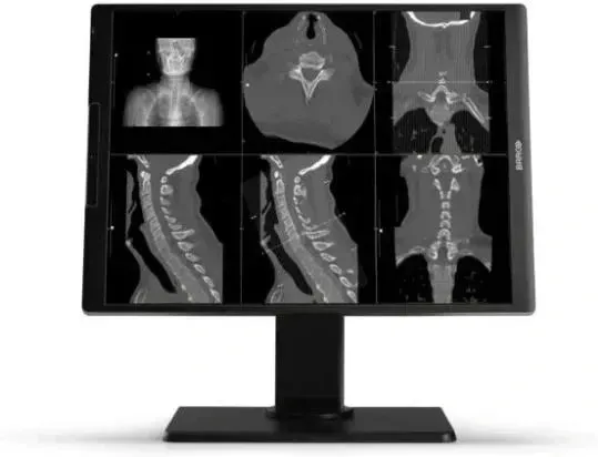 Монитор Barco Medical  Medyczny Nio Color 2Mp Mdnc-2521 Snes (NIOC2MPSNES) Киев - изображение 1