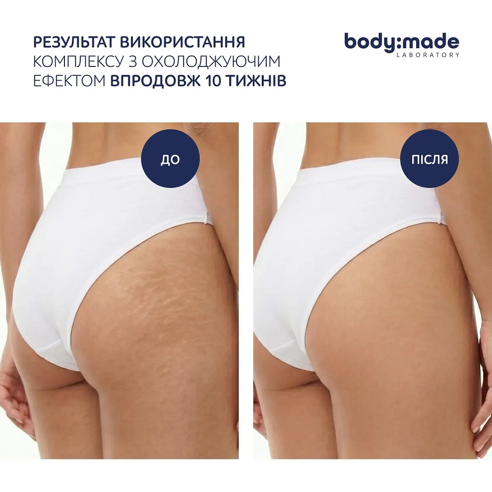 Штаны для бандажного обертывания BodyMade Киев - изображение 4