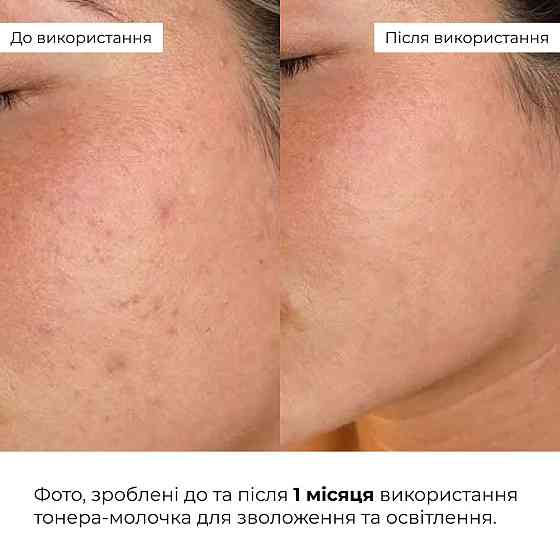 Набір для зволоження та сонцезахисту шкіри Hillary Moisturizing & SPF Protection Set Киев