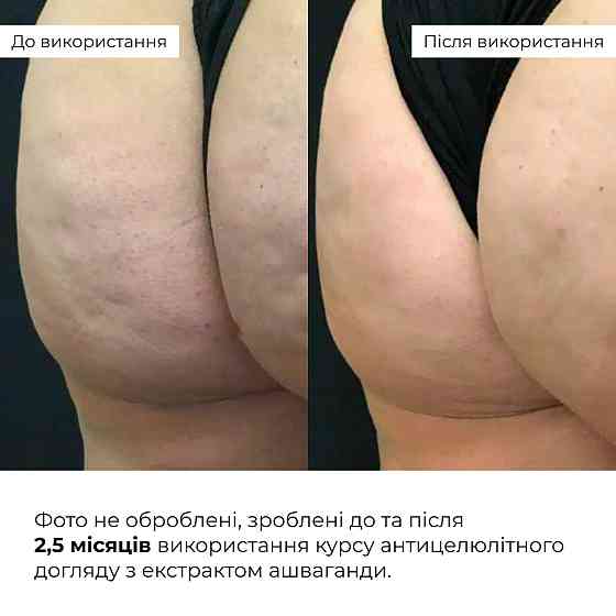 Курс антицелюлітного догляду в домашніх умовах з екстрактом ашваганди Ashwagandha Anti-Cellulite Care Hillary Київ