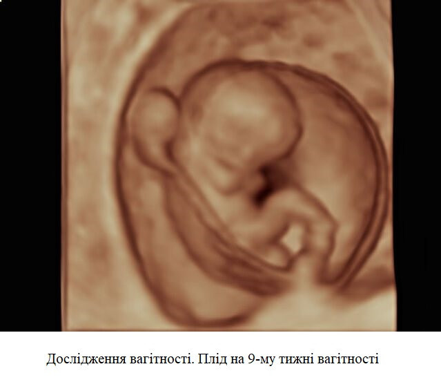 Ультразвуковий апарат (УЗД) Voluson™ P8 Дніпро - фото 3