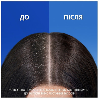 Шампунь Head & Shoulders 2 в 1 Против перхоти Гладкие и шелковистые 330 мл (8700216304856) Винница - изображение 3