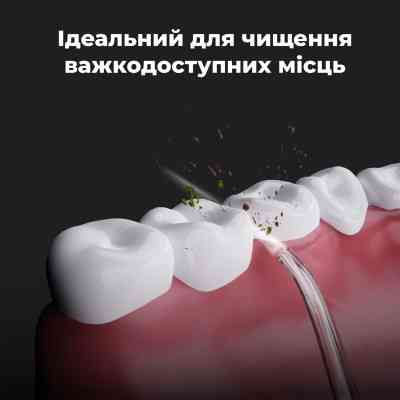 Іригатор AENO ADI0002 Вінниця