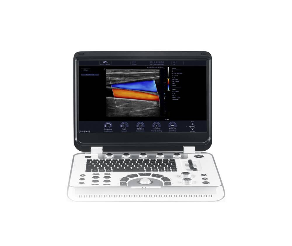 Ультразвукова діагностична система портативна експертного класу +2 датчики Finus 70 Focus & Fusion Дніпро - фото 5