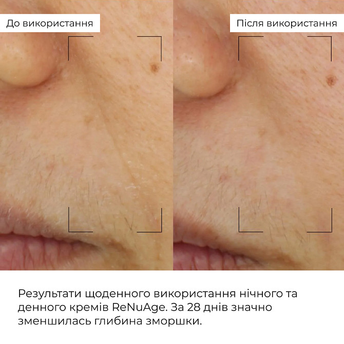 Комплекс щоденного антивікового догляду ReNuAge Daily Anti-Aging Care Complex Hillary Вінниця - фото 13