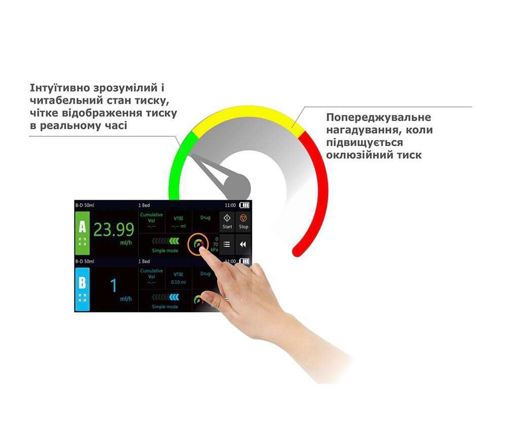 Двоканальний шприцевий насос DSP5 BYOND Дніпро - фото 3