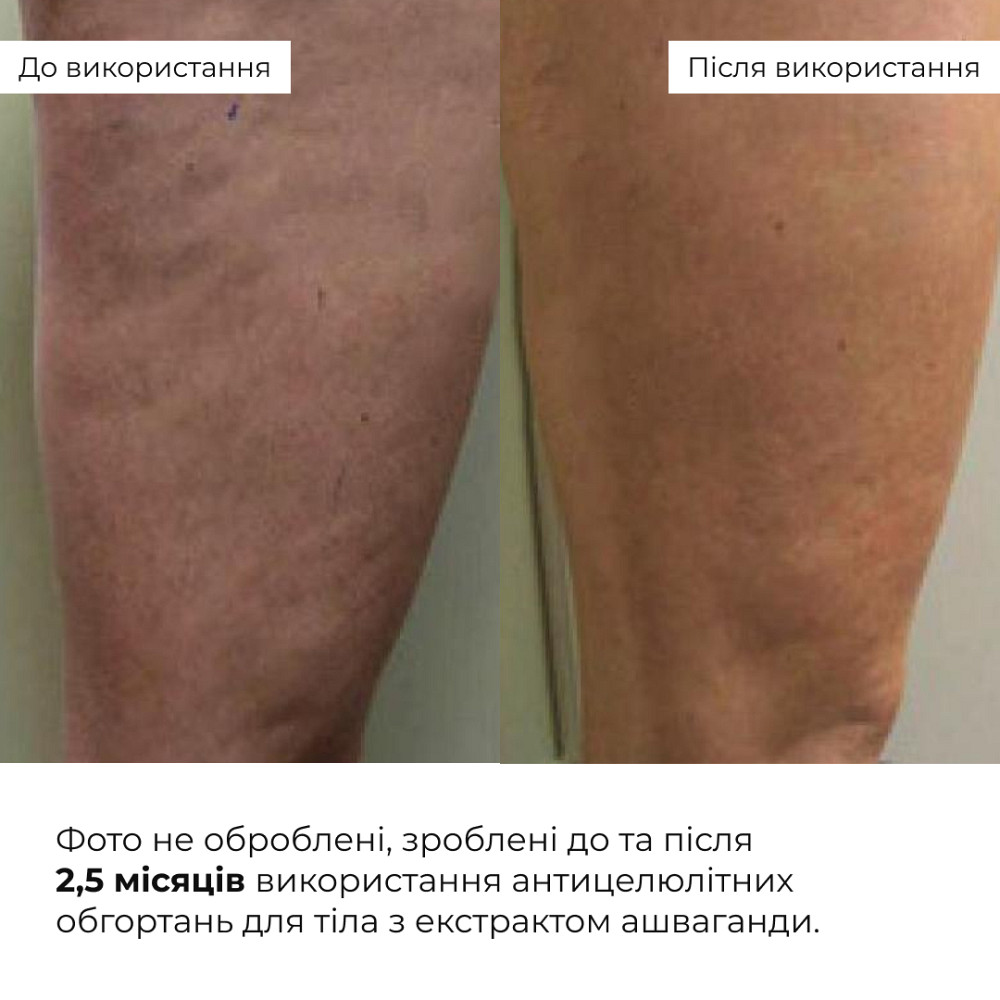 Антицелюлітні моделюючі обгортання для тіла з екстрактом ашваганди Ashwagandha Hot Slim Hillary 100 г Київ - фото 4