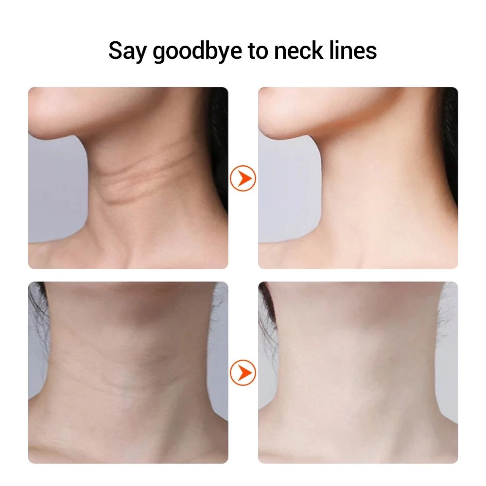 Микротоковый массажер Neck Beauty Device для шеи и лица Винница - изображение 5