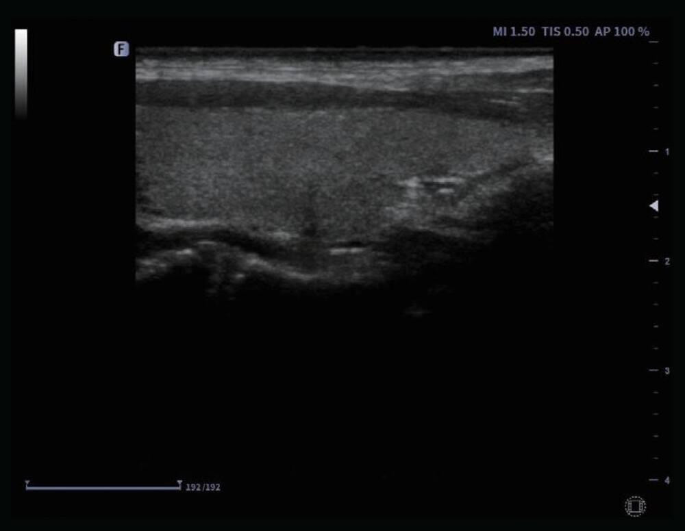 Ультразвукова діагностична система портативна Finus 45 Focus&Fusion Дніпро - фото 6