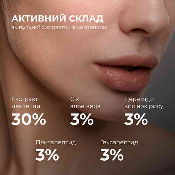 Набір для заспокоєння шкіри та підтримки захисного бар’єра Hillary Soothing & Skin Barrier Support Set Київ