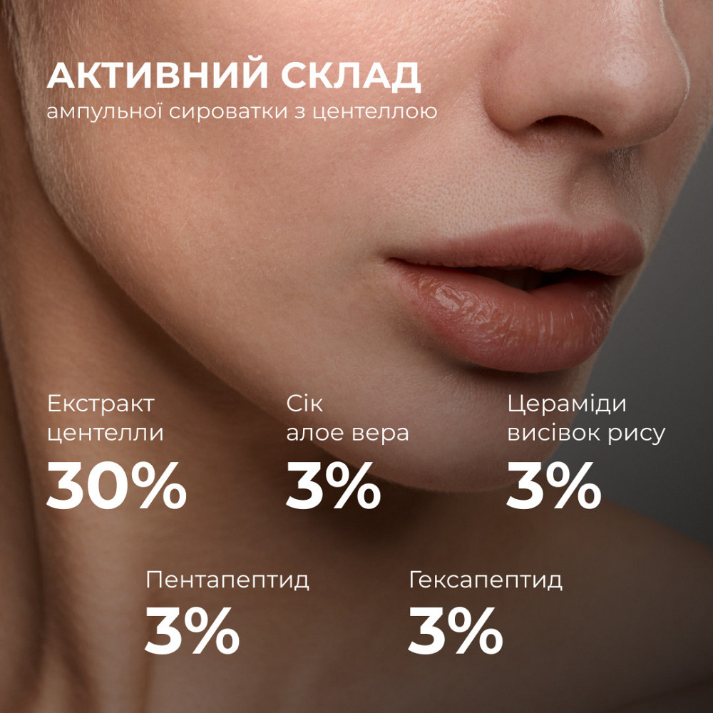 Набор для успокоения кожи и поддержки защитного барьера Hillary Soothing & Skin Barrier Support Set Киев - изображение 3