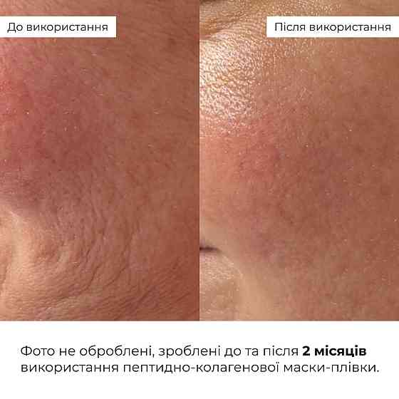 Комплекс пептидного омоложения и коррекции морщин Hillary Collagen & Peptide Anti-Age & Wrinkle Correction Set Киев