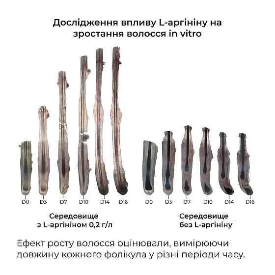 Мезороллер для шкіри голови Hillary + Сироватка та маска проти випадіння волосся Київ