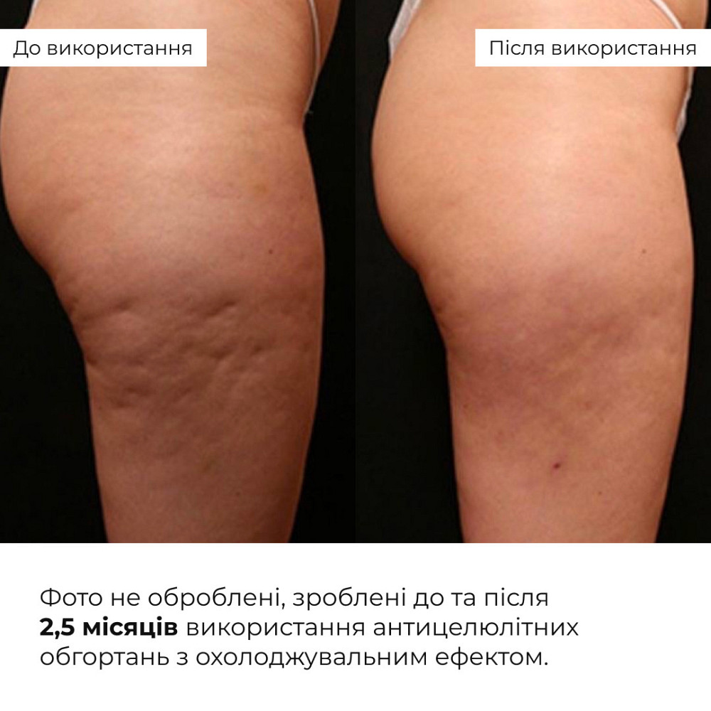 Комплекс охолоджуючих антицелюлітних обгортань для тіла Hillary Anti-Cellulite Pro Max cooling effect (10 уп.) Київ - фото 14