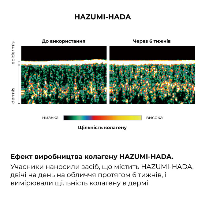 Комплекс моделюючого догляду з екзосомами та пептидами ReNuAge Sculpting Care Complex with Exosomes and Peptides Hillary Вінниця - фото 14