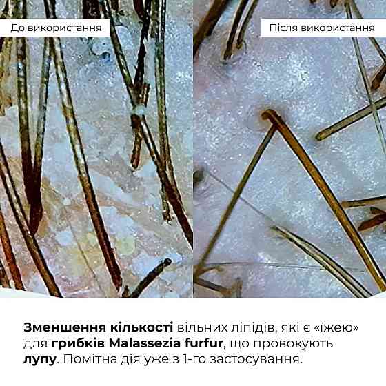 Комплекс для глибокого очищення та відновлення волосся і шкіри голови з термозахистом Hillary Deep Cleanse & Hair Restoration Set Київ