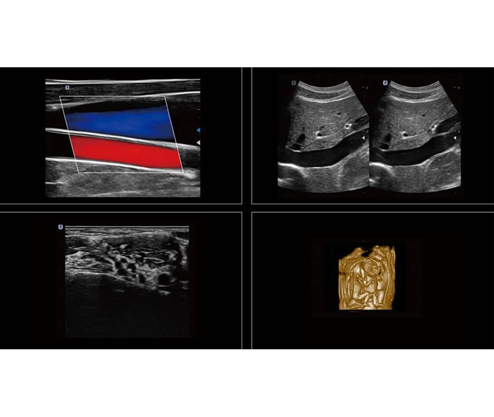 Ультразвукова діагностична система стаціонарна високого класу +2 датчики Danus 10 Focus & Fusion Дніпро - фото 9