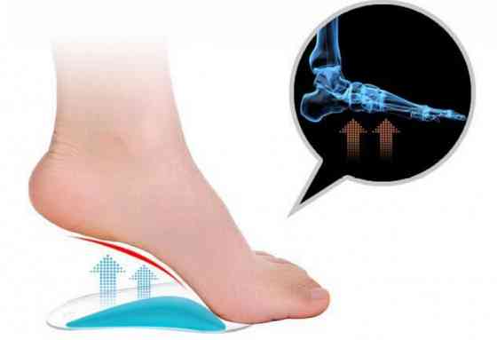 Ортопедичні силіконові вставки для взуття Вінниця