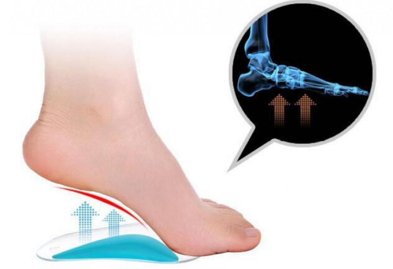 Ортопедичні силіконові вставки для взуття Вінниця - фото 6