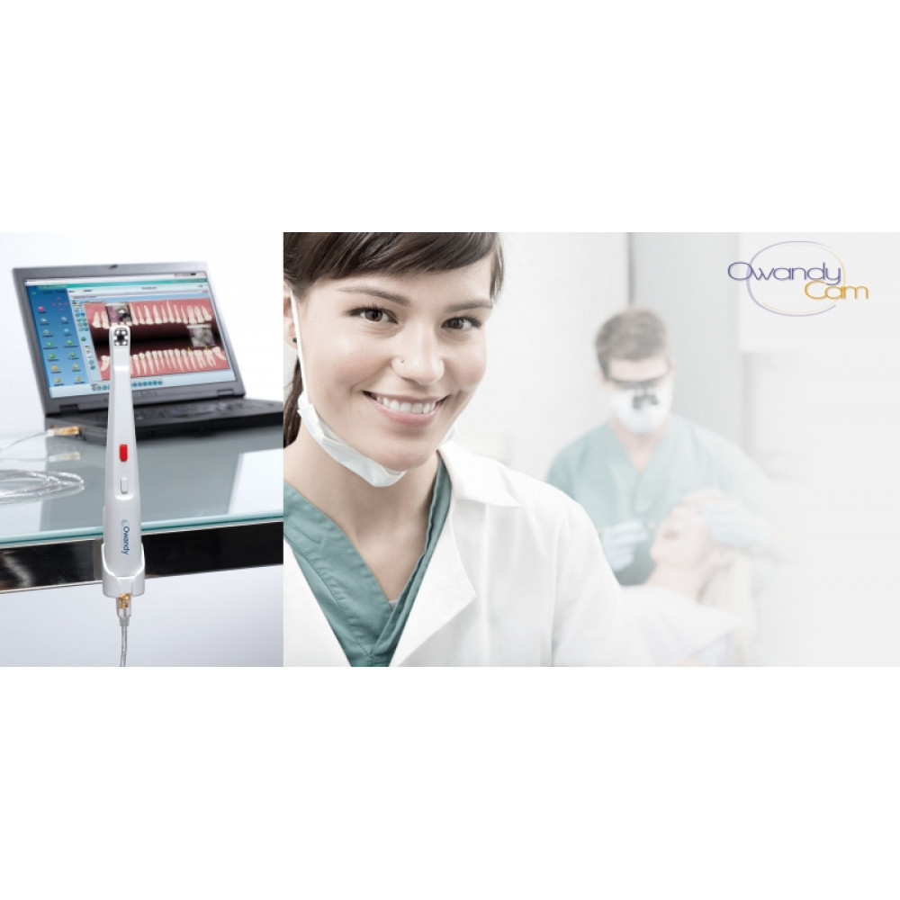 Інтраоральна камера OwandyCam Дніпро - фото 2