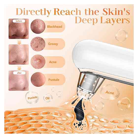 Вакуумний очищувач пор комедонний екстрактор Yccu Blackhead Remover Y002 Білий 4 насадки 4 режими USB зарядка ABS Київ