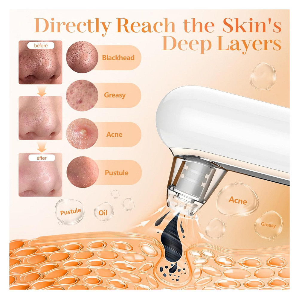 Вакуумний очищувач пор комедонний екстрактор Yccu Blackhead Remover Y002 Білий 4 насадки 4 режими USB зарядка ABS Київ - фото 6