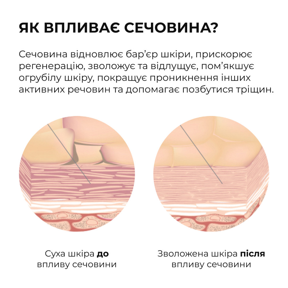 Восстанавливающий крем для сухой и потрескавшейся кожи ног HydraHeel Urea & Lanolin Repair Cream Hillary 100 мл Киев - изображение 8