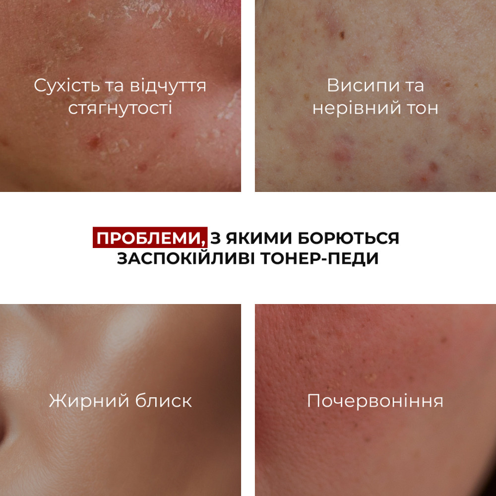 Успокаивающие тонер-педы с экзосомами центеллы Centella Exosome Soothing Pads Hillary 60 шт Киев - изображение 9