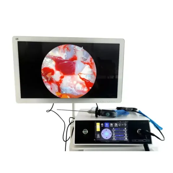 Ендоскопічна відеосистема FHD TUYOU LSD90TB 3-в-1 із функцією відеозапису (сенсорний екран) Дніпро