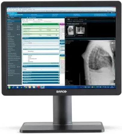 Монитор Barco Medical  Medyczny Eonis 21