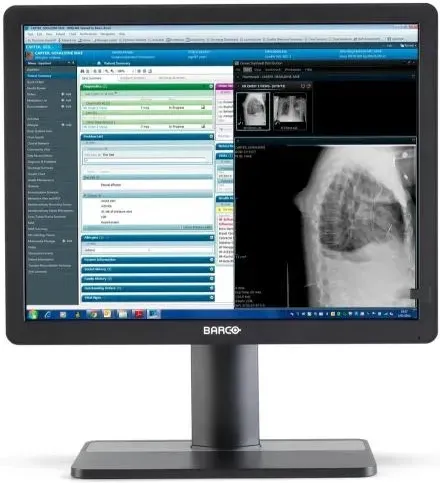 Монитор Barco Medical  Medyczny Eonis 21