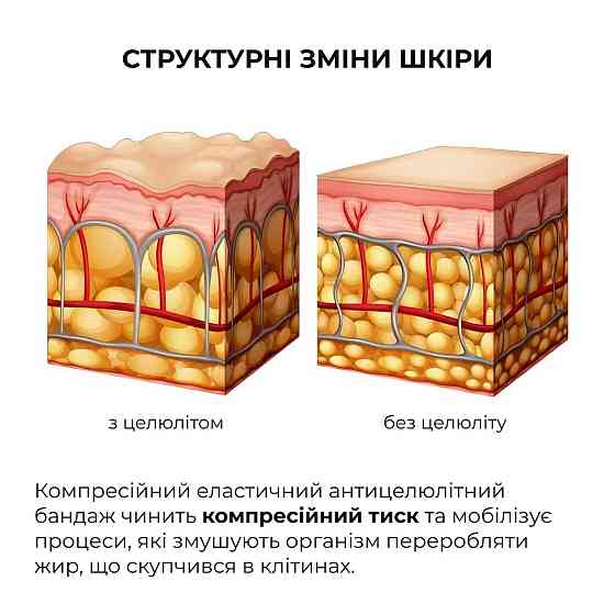 Антицеллюлитные энзимные обертывания Hillary Anti-cellulite Bandage Zymo Cell Киев