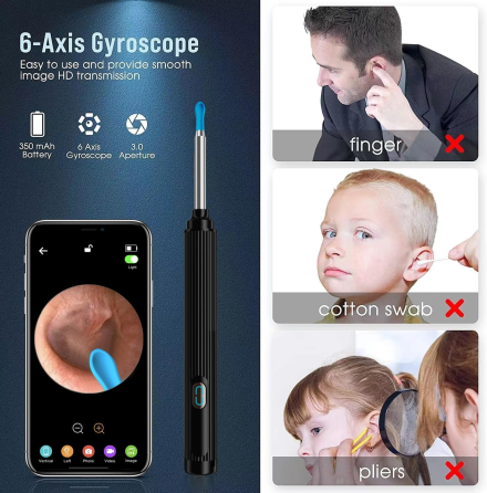 Вушний отоскоп CC10 з камерою 1080P, Wi-Fi, 6 LED, силіконові насадки, для iOS та Android, чорний Київ