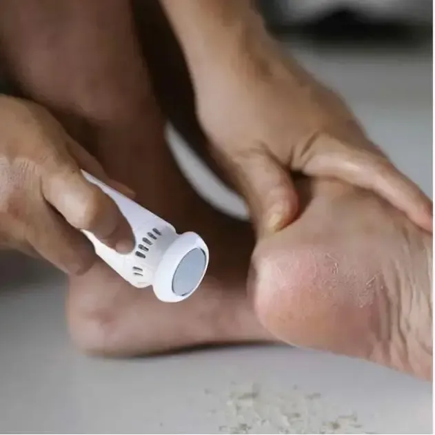 Пемза электрическая FOOT GRINDER 928-3 для ног и пяток с насадками Коломия - фото 2