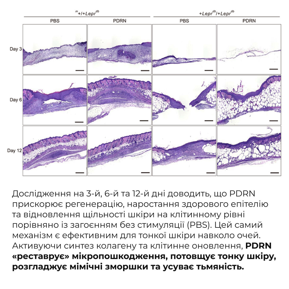 Полинуклеотидный крем-гель для сияния кожи вокруг глаз PDRN Eye Cream-Gel with Caffeine & Peptides Hillary 12 мл Киев - изображение 13