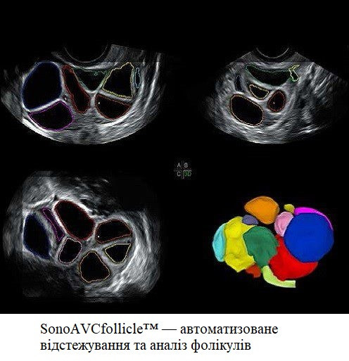 Ультразвуковий апарат (УЗД) Voluson™ SWIFT Дніпро - фото 8