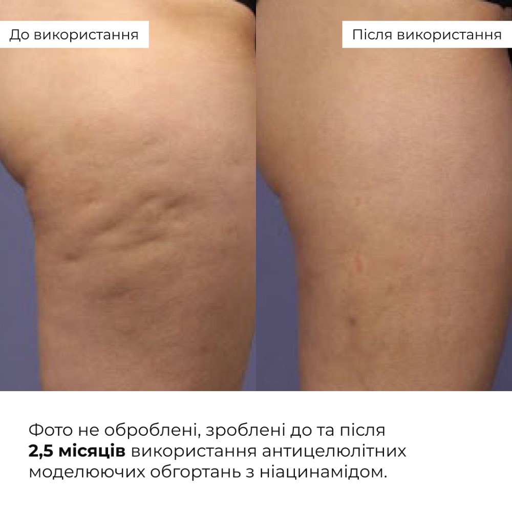 Комплекс антицеллюлитных моделирующих обертываний с Ниацинамидом Niacinamide Cold Slim Hillary (10 уп.) Киев - изображение 4