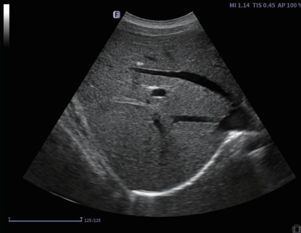 Ультразвукова діагностична система портативна Finus 45 Focus&Fusion Дніпро - фото 8