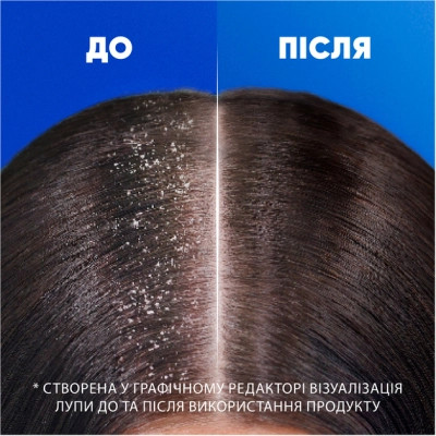Шампунь Head &amp; Shoulders Цитрусова свіжість 400 мл (5011321336032) Вінниця - фото 4