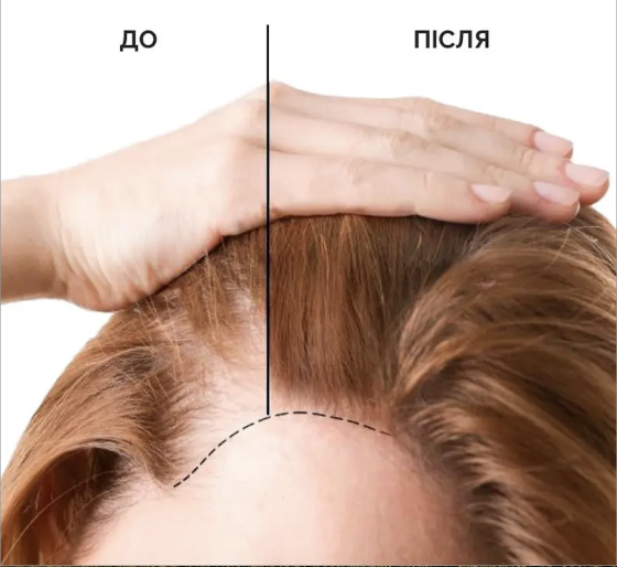 Сыворотка-стимулятор для роста и против выпадения волос Reclaire cosmetics 100 мл Киев