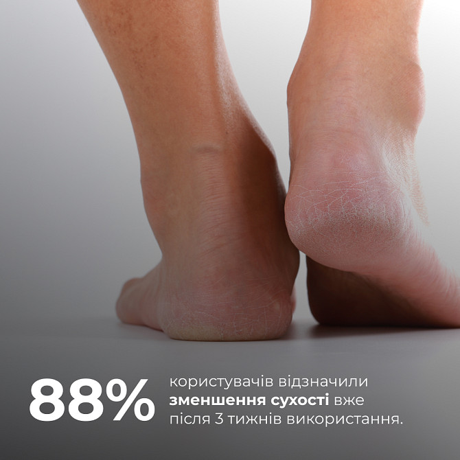 Відновлювальний стік для п’ят із розмарином і ромашкою HydraHeel Care Stick Rosemary Chamomile Repair Hillary Вінниця - фото 9