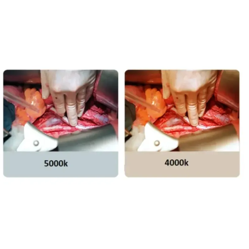 Операційна лампа Wellman WL500 одинарна Дніпро - фото 4