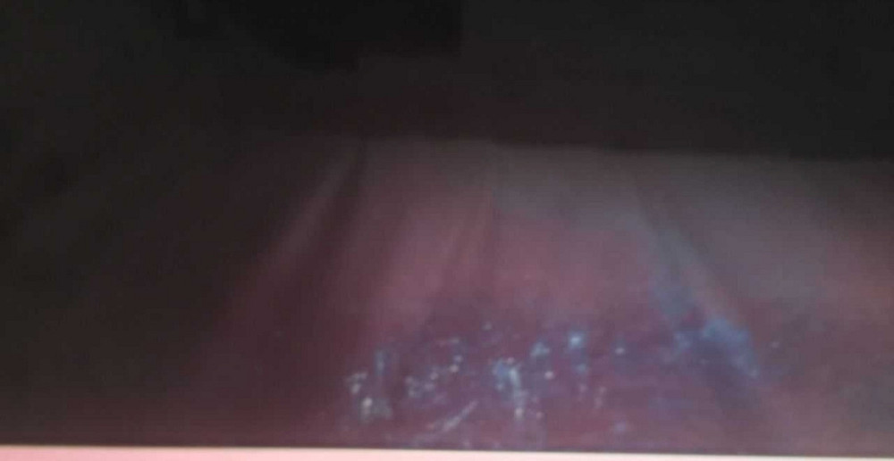 Телевизор Безрамный: 65