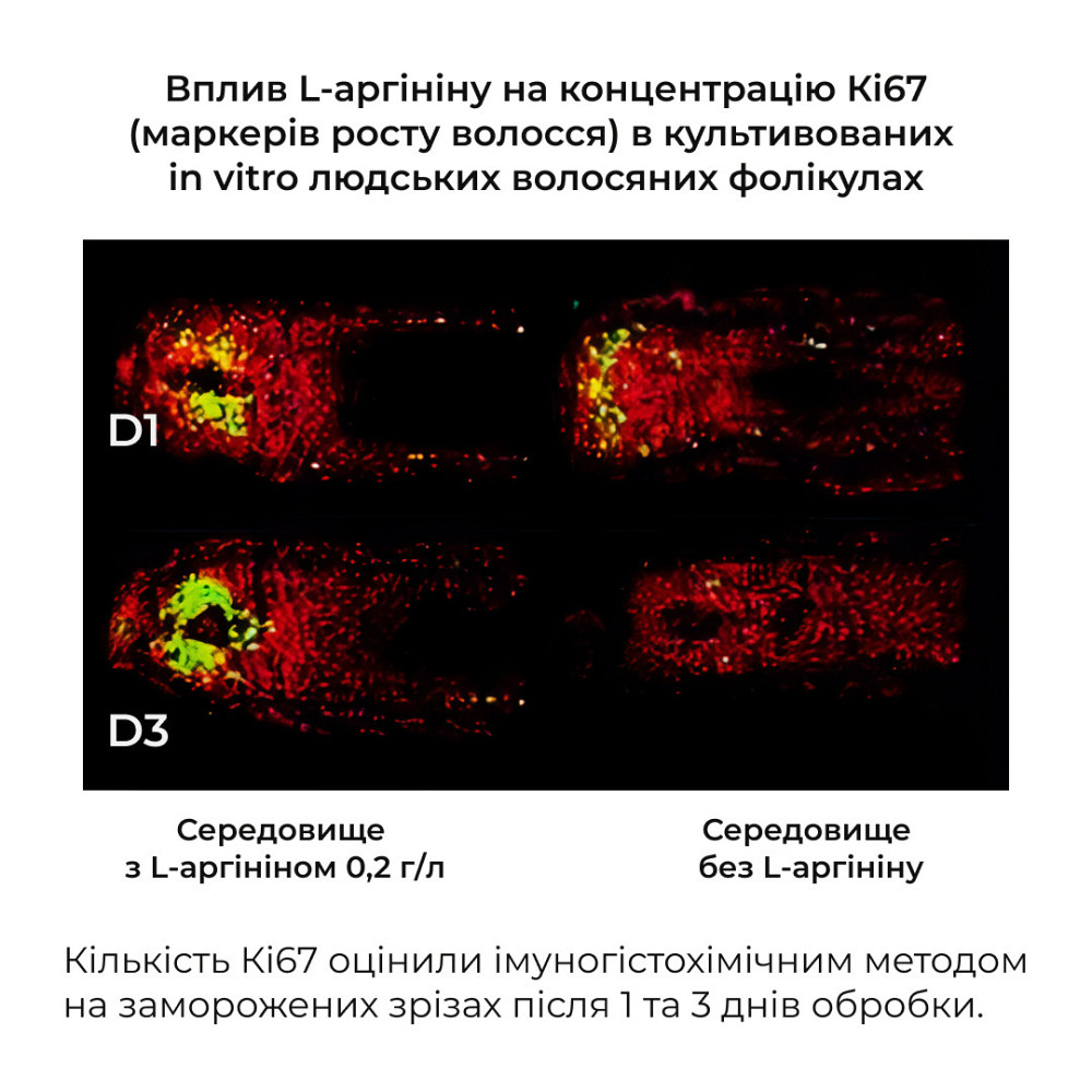 Кондиціонер проти випадіння волосся Hillary Serenoa & РР Hair Loss Control Сonditioner, 250 мл Київ - фото 7
