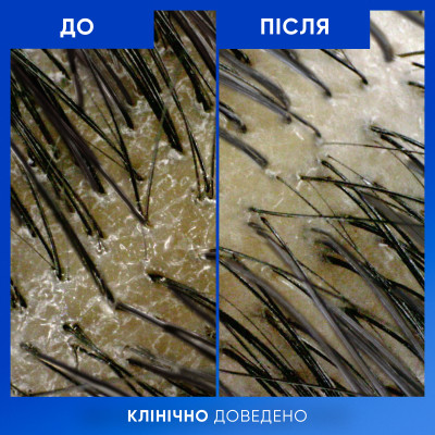 Шампунь Head & Shoulders Clarify & Shine Против перхоти Очищение и блеск 400 мл (8700216658461) Винница - изображение 7